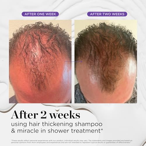 Dr. Groot Hair Thickening Shampoo, Korean Hair Care with Biotin, Rosemary Oil to Help Volumize Thinning, Damaged Hair, Hydrate Hair and Scalp, Biotin Shampoo, Scalp Revitalizing Solution