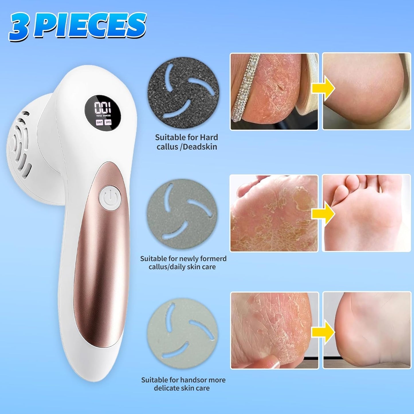 Electric Feet Foot Callus Remover Equipped with A Vacuum System Foot Scrubber 17 in 1 Professional Foot Care Tool Ipx6 Waterproof Rating for Removing Hard Cracks Dryness and Dead Skin (White)