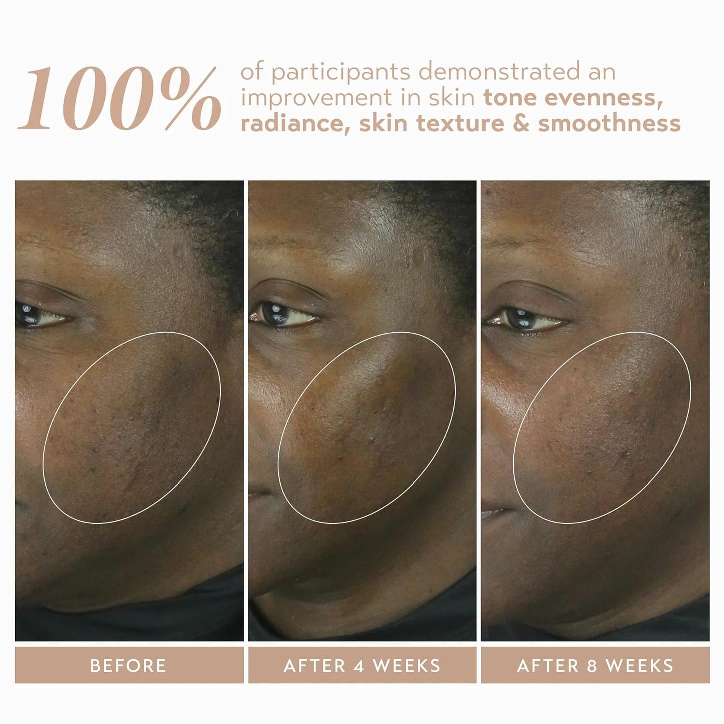 SHANI DARDEN SKIN CARE Retinol Reform with 1% Encapsulated Retinol Serum for Face & Neck, Gentle Slow-Release Retinol Face Serum with Tripeptide for Wrinkles, Fine Lines & Uneven Tone, 0.3 fl oz