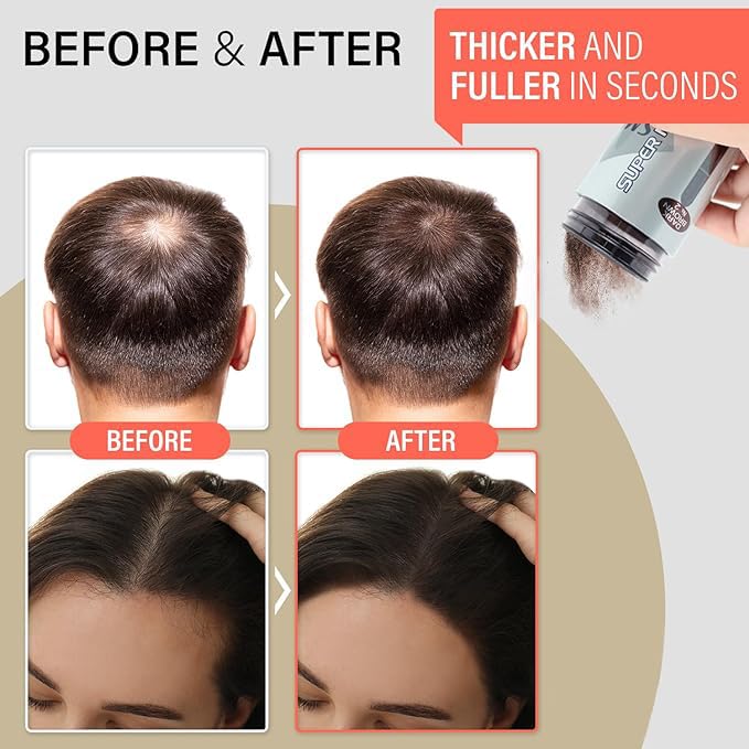 SMH Hair Fibers MADE IN JAPAN – Instantly Conceals Thinning Hair –Long-Lasting, Natural Look – Sweat, Water & Wind Resistant – For Men & Women (10g, White)