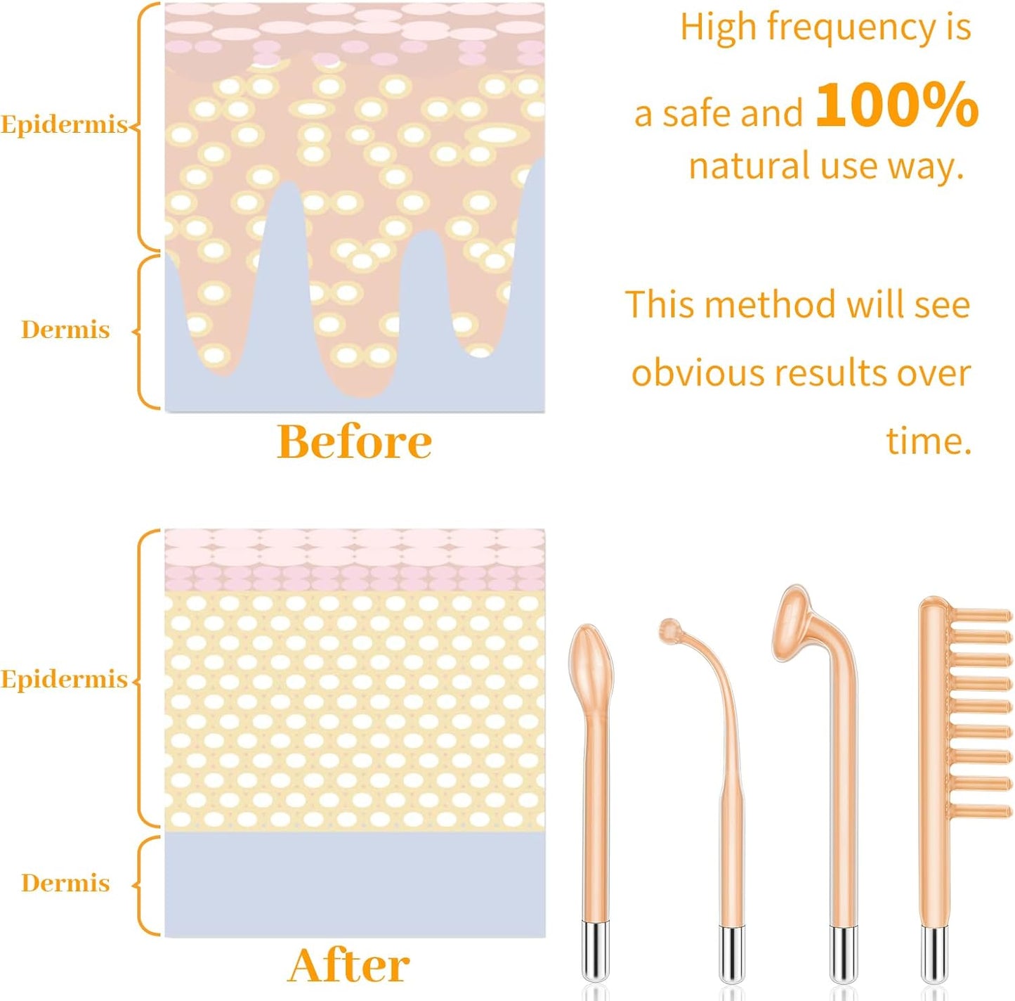 MYSWEETY High F Rrequncy Portable Handheld Facial Skin Care Wand Machine