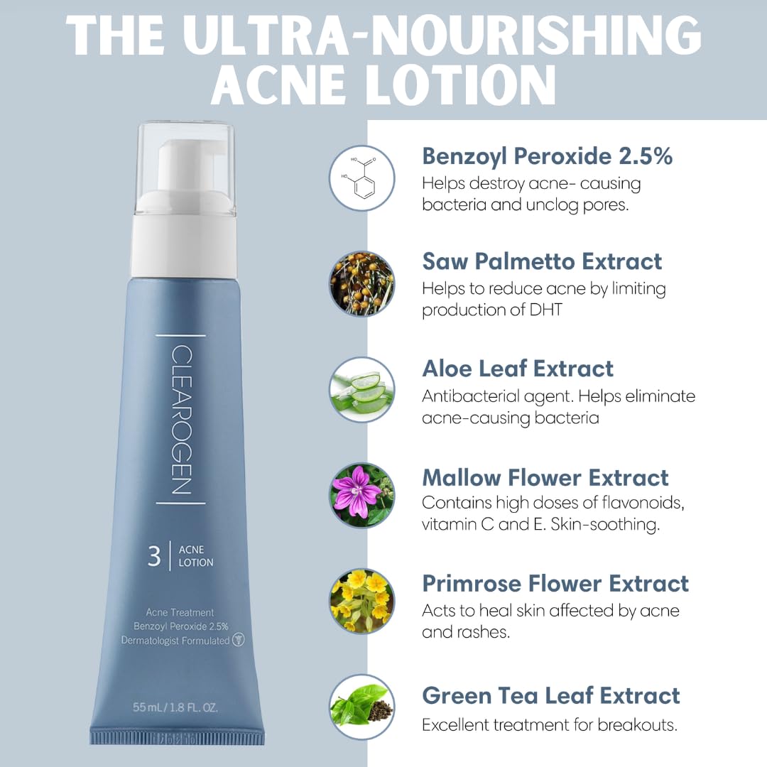 Acne Lotion with Benzoyl Peroxide, Acne Cream, Face Moisturizer Acne Prone Skin, Acne Moisturizer for Face, 1.8 Fl oz