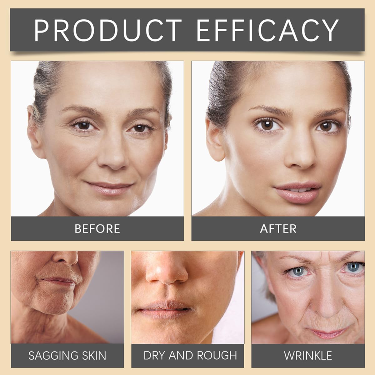 Bee Venom Moisturiser Cream Wrinkle Removal & Firming, Anti-Aging Eye&Face Bee Venom Skin Treatment Cream, Natural And Non-Irritating, Lifting & Recovery For All Skin Type (1 Pack, 20g)