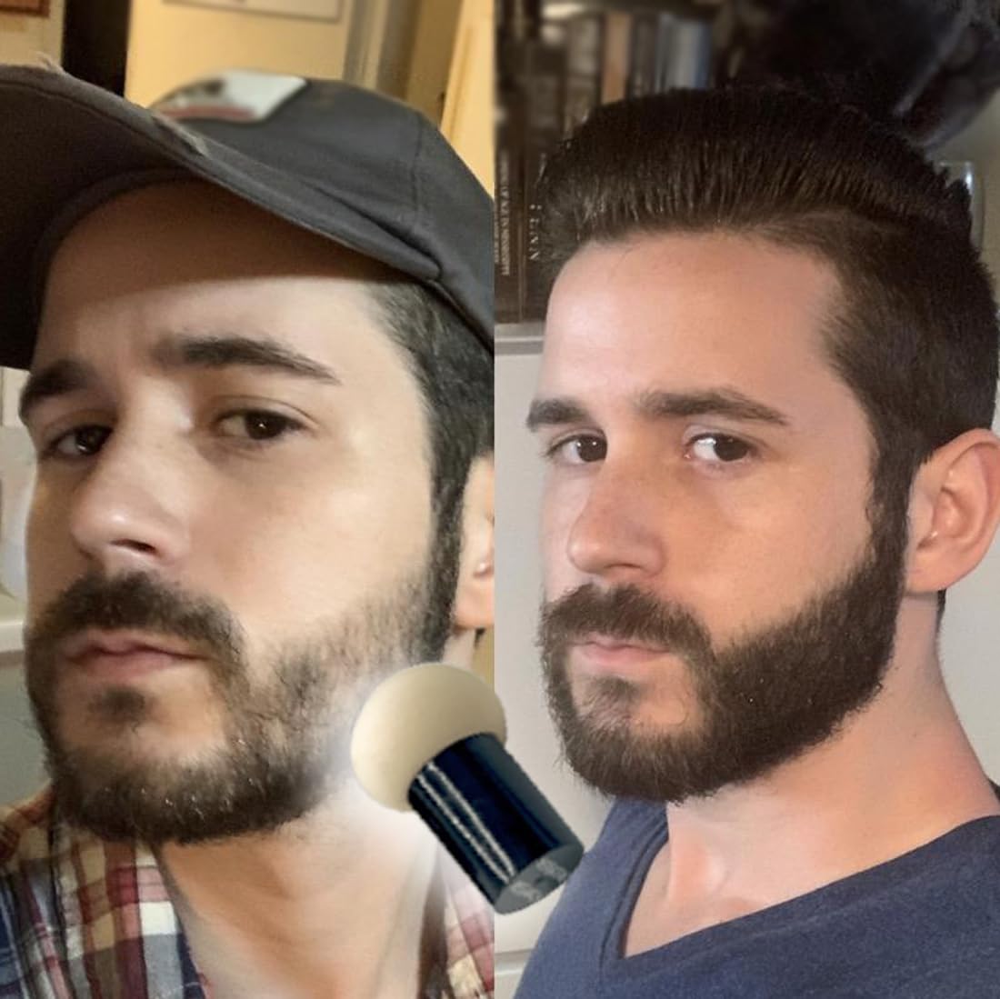 KERATIN RESEARCH Hairline Filler Unisex Mineral Powder Root Touch-Up Hair loss Concealer Scalp & Beard Bald Patch Coverage Fibers for Thinning Hair Waterproof Organic Natural look (BLACK, XL)