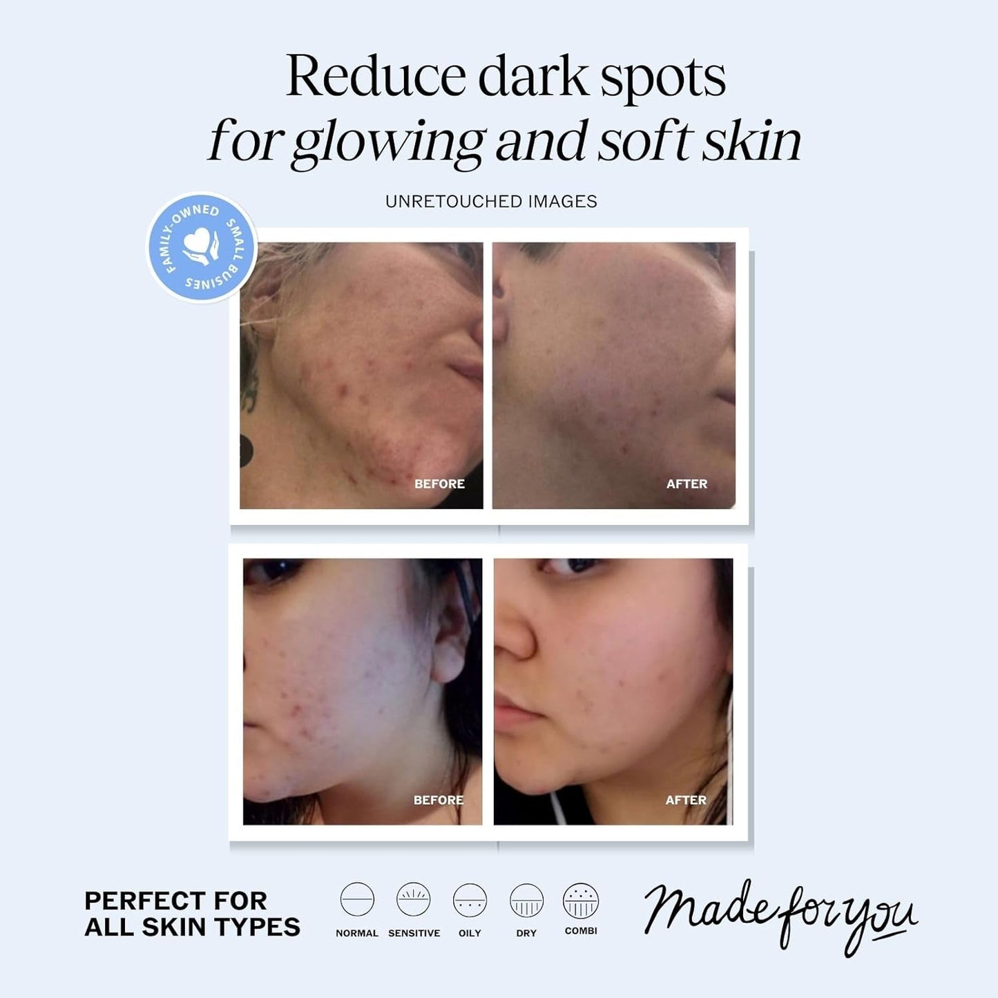 LilyAna Naturals Vitamin C Serum for Face with Hyaluronic Acid and Vitamin E, Anti Aging Serum, Reduces Age Spots and Sun Damage, Promotes Collagen and Elastin (1oz)