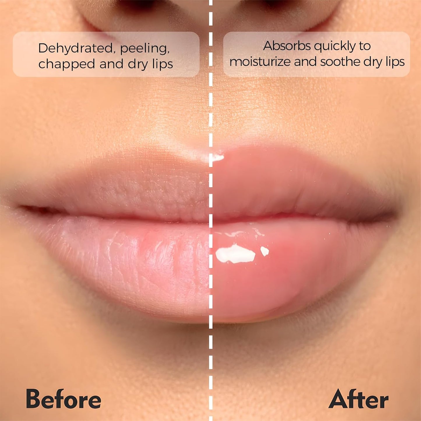 Deep Hydrating Lip Butter Balm | Plump & Nourish with Shea Butter, Vitamin E, Peptides & Hyaluronic Acid | Vegan, Non-Sticky, Anti-Aging Lip Treatment Care | 2-Pack (Clear-Unscented)