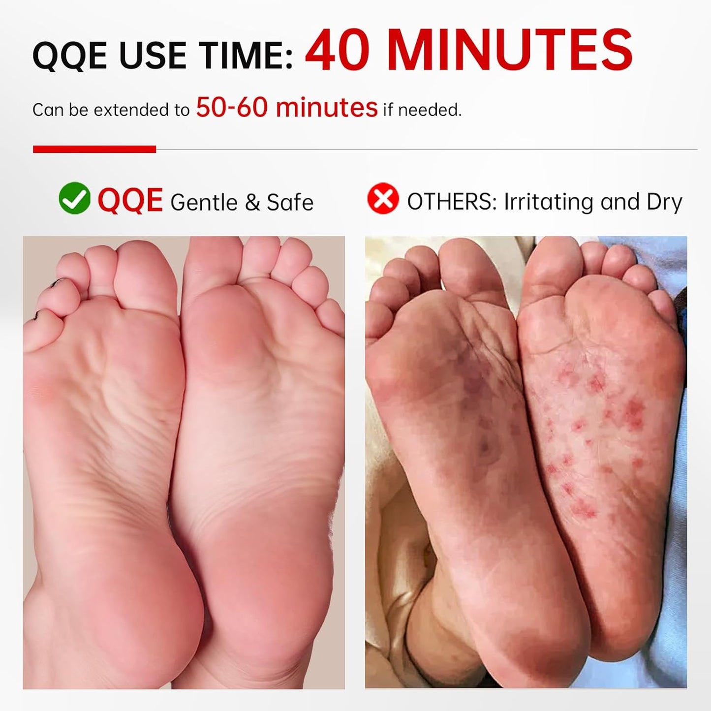 3 Pack Foot Peeling Mask, Hydrating Exfoliating Foot Mask for Dry Cracked Feet, Callus Remover & Cracked Heel Repair & Foot Care