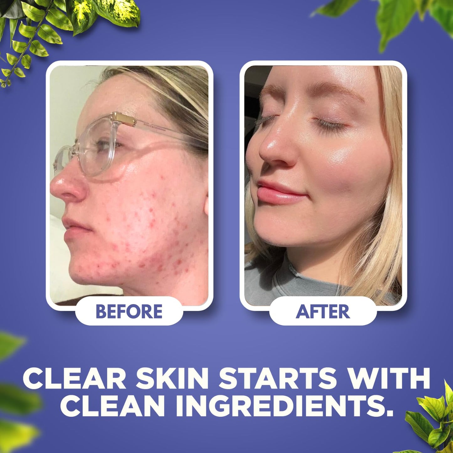 Whipped Beef Tallow for Skin - Face + Body Moisturizer, 100% Grass Fed Grass Finished Tallow and Honey Balm for Sensitive Skin - Natural Lotion - Free of Harsh Chemicals - 4oz, (Unscented)