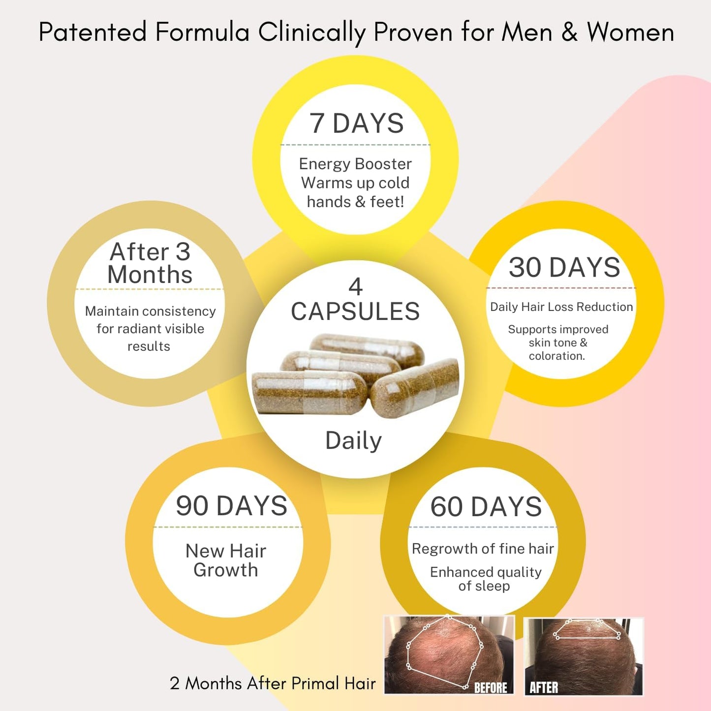100% Natural Growth Treatment, Reduces Hair Loss, US Patented Formula Proven Effective for Men & Women, 100% Vegan Ingredients, Non-GMO, 30-Day Supply