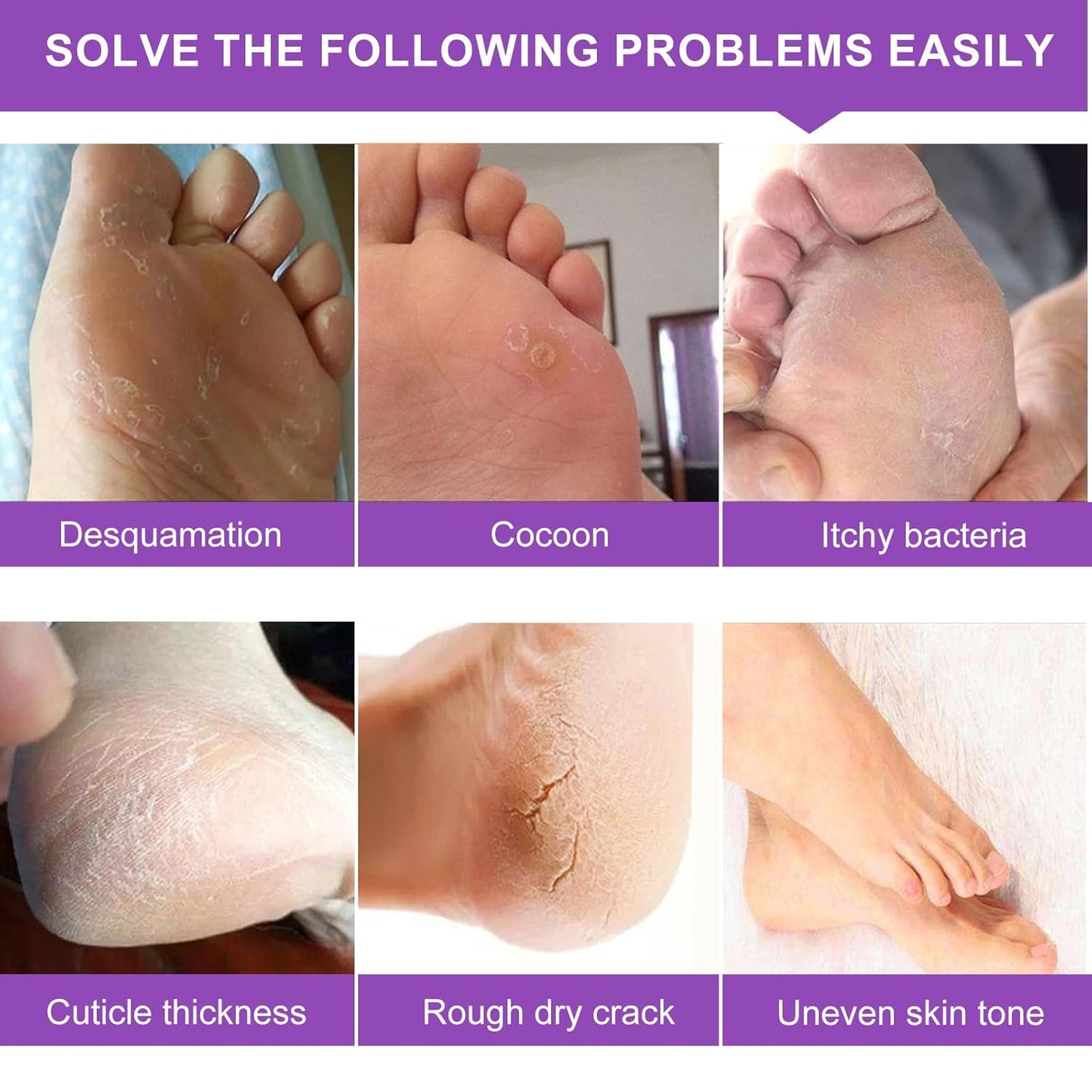 Foot Peeling Mask 5 Pack, Moisturizing Socks for Dry Foot Care, Hydrating Feet Peel Masks Repair Dry Cracked Heels, Remove Dead Skin,Callus - Women Men (Lavender)