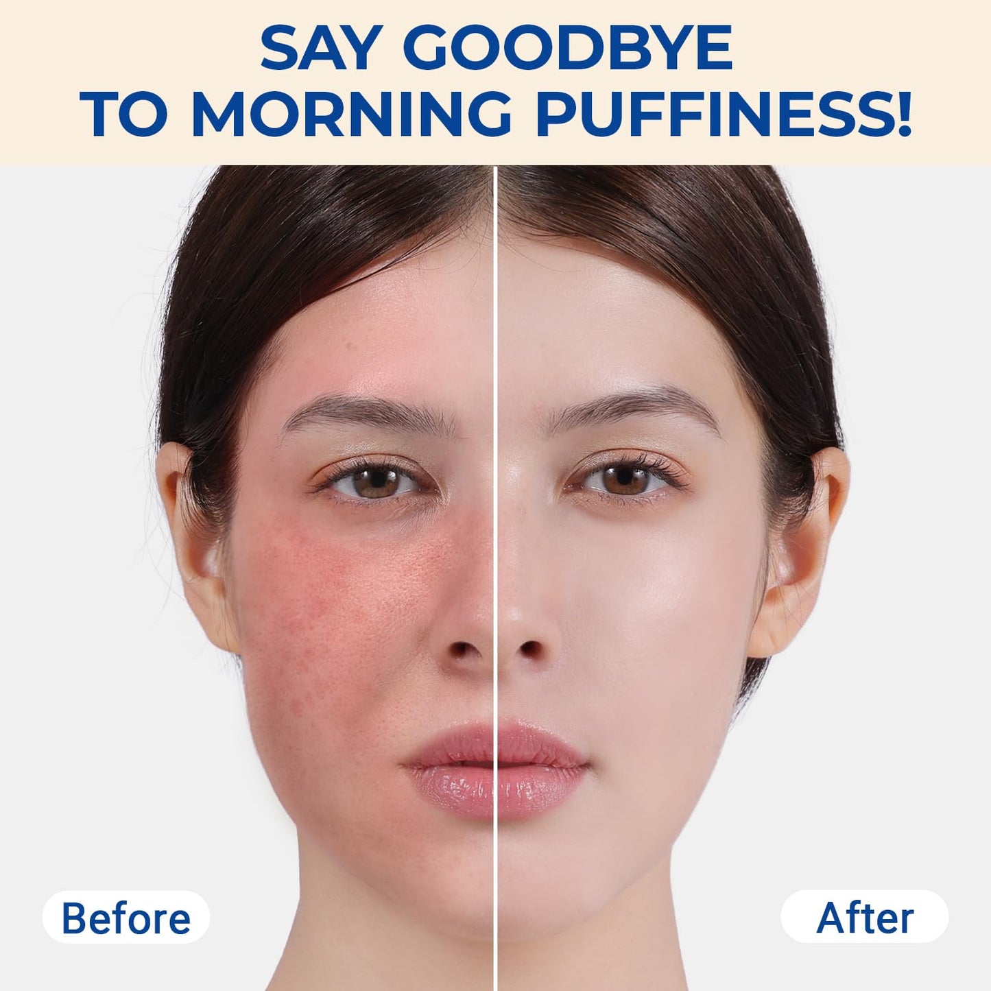 MORGLES Ice Roller for Face and Eyes, Ice Face Roller for Women Skin Care, Cold Facial Roller for Puffiness, Migraine Relief and Lymphatic Drainage