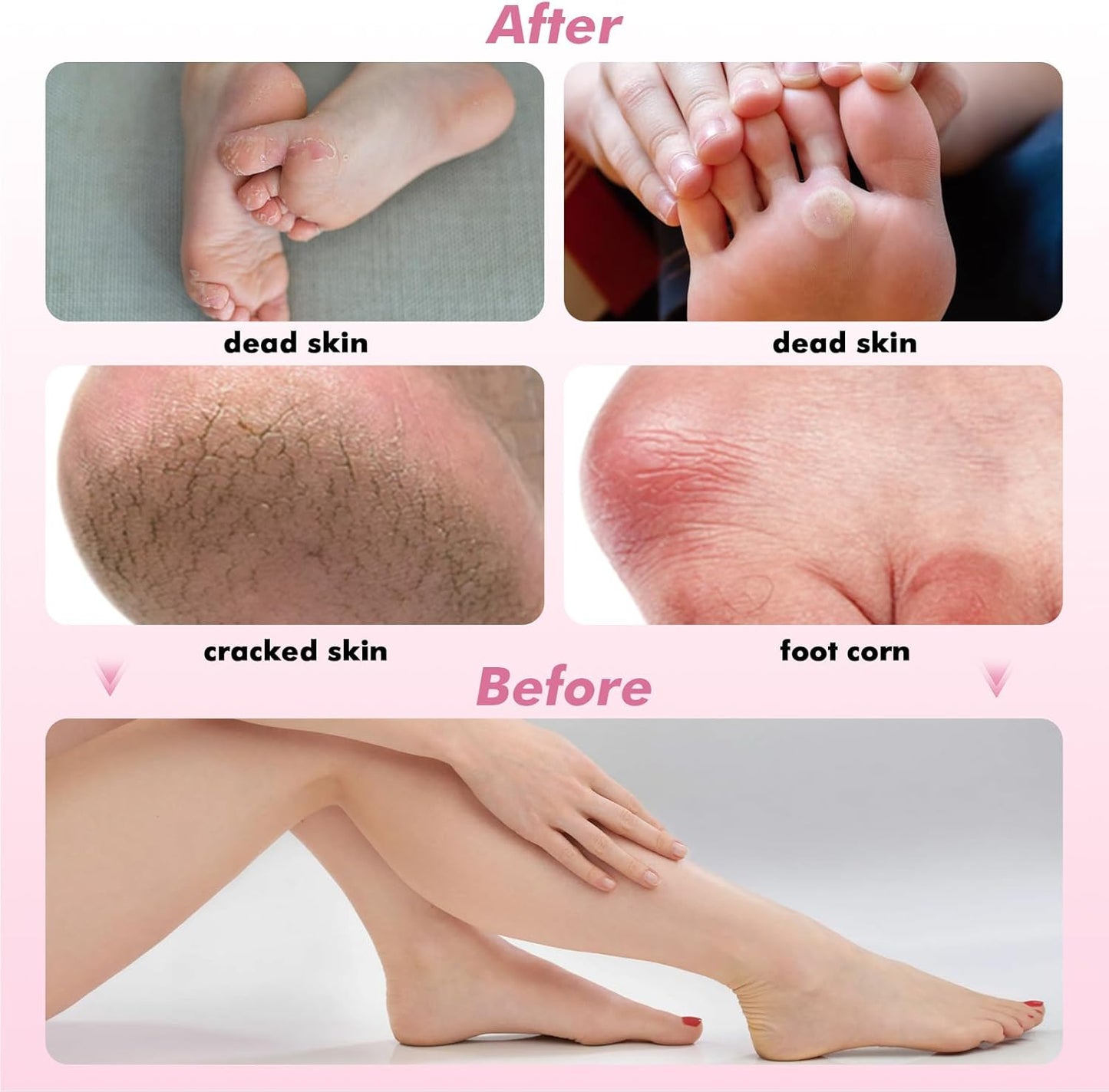 2 in1 Electric Foot Callus Remover Waysse Callus Remover for Feet with Replacement Sandpaper Discs, Adjustable Speed Electric Foot File Professional Pedicure Tool for Dead Skin Calluses