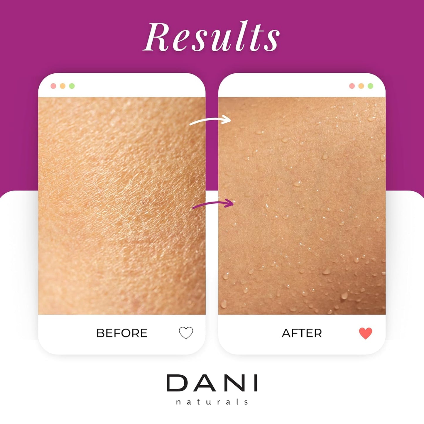 Naturals Sugar Scrub – Pure & Gentle Exfoliation with Juicy Passion Fruit Scent. Organic sugar, shea butter, and nourishing oils for smooth, soft skin – 14 oz