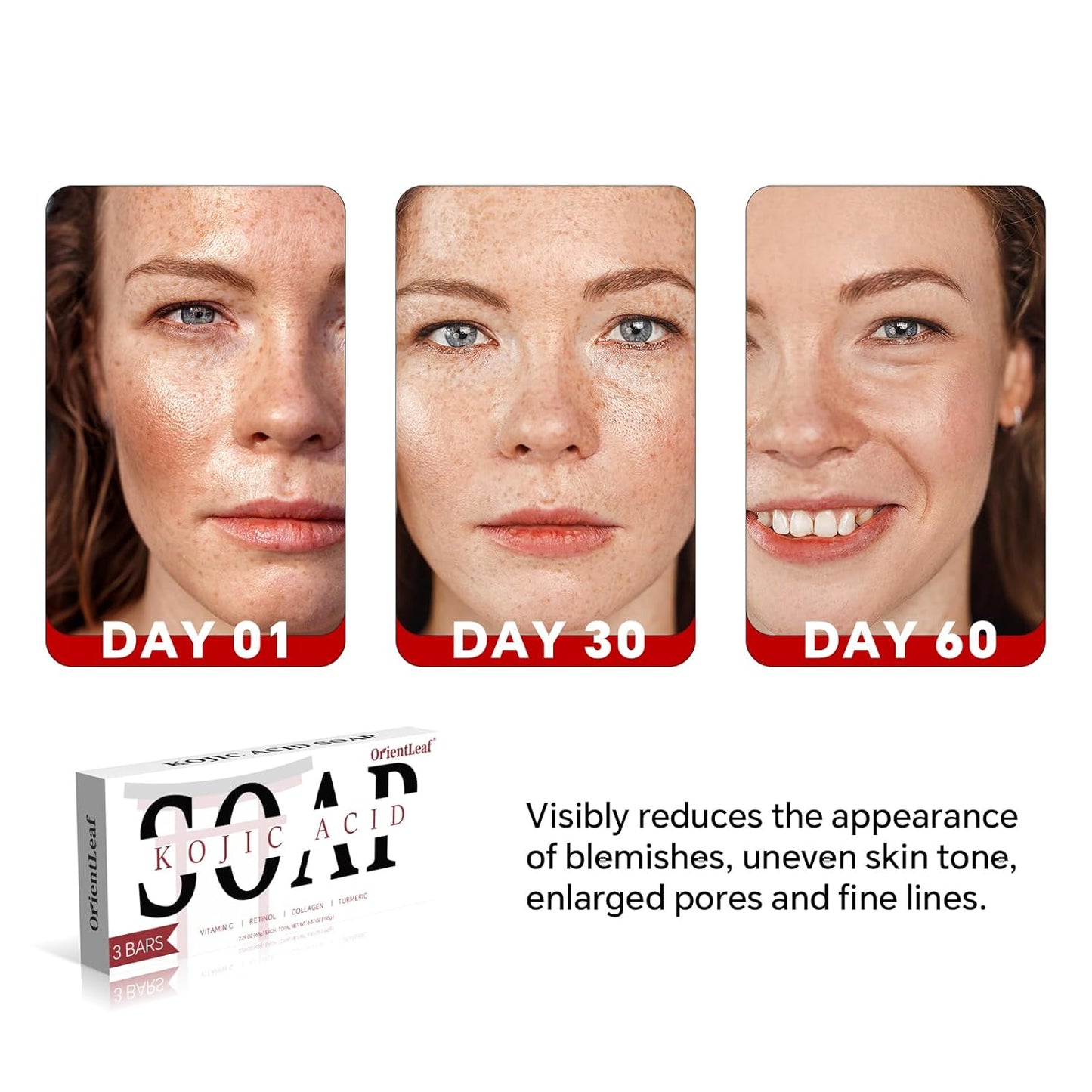 Kojic Acid Soap, Turmeric Soap Bar for Dark Spots, Fresh Citurs Scent, Gentle for Face and Body Wash with Vitamin C, Shea Butter, Retinol, Olive Oil, Collagen (3 PACK)