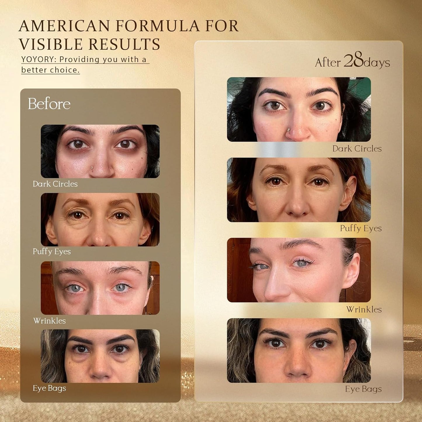 Retinol Under Eye Cream - Anti Aging Eye Cream for Dark Circles and Puffiness, Eye Bags, Wrinkles Fine Lines Skin Care Treatment Firming & Lifts for Man and Women - Gold 20ml