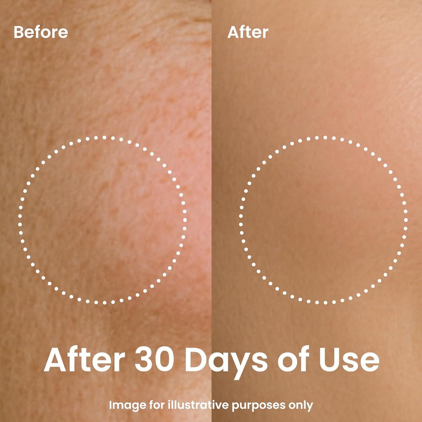 CICA Refreshing Gel Cream (2.7 FL OZ) Face Moisturizer for Dry Skin, Acne-Prone, Sensitive Skin with Vitamin C, Centella Asiatica, Niacinamide, Hydrating, Soothing, Korean Made