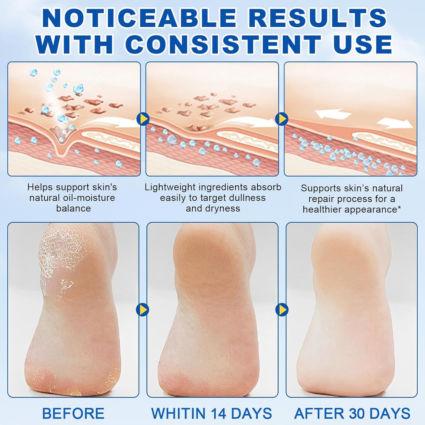 60% Urea with 2% Salicylic Acid Urea Foot Care Stick, Foot Cream Moisturizer for Dry Cracked Feet, Knees, Elbows, Hands,Moisturizes and Hydrates the Dry Skin,Callus Remover & Skin Softener -1.41oz