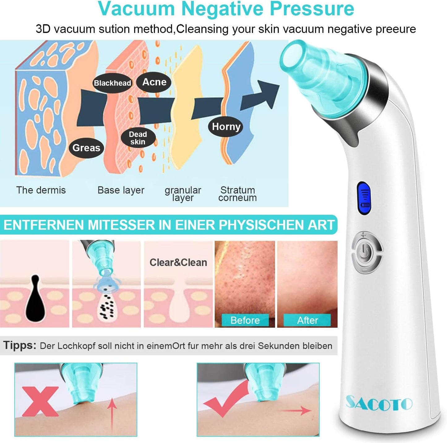 Blackhead Remover Pore Vacuum, Face Suction Pore Cleanser, 5 Suction Power Electric Blackhead Extractor Tool, 4 Probes, Blackhead Suction Remover for Women & Men