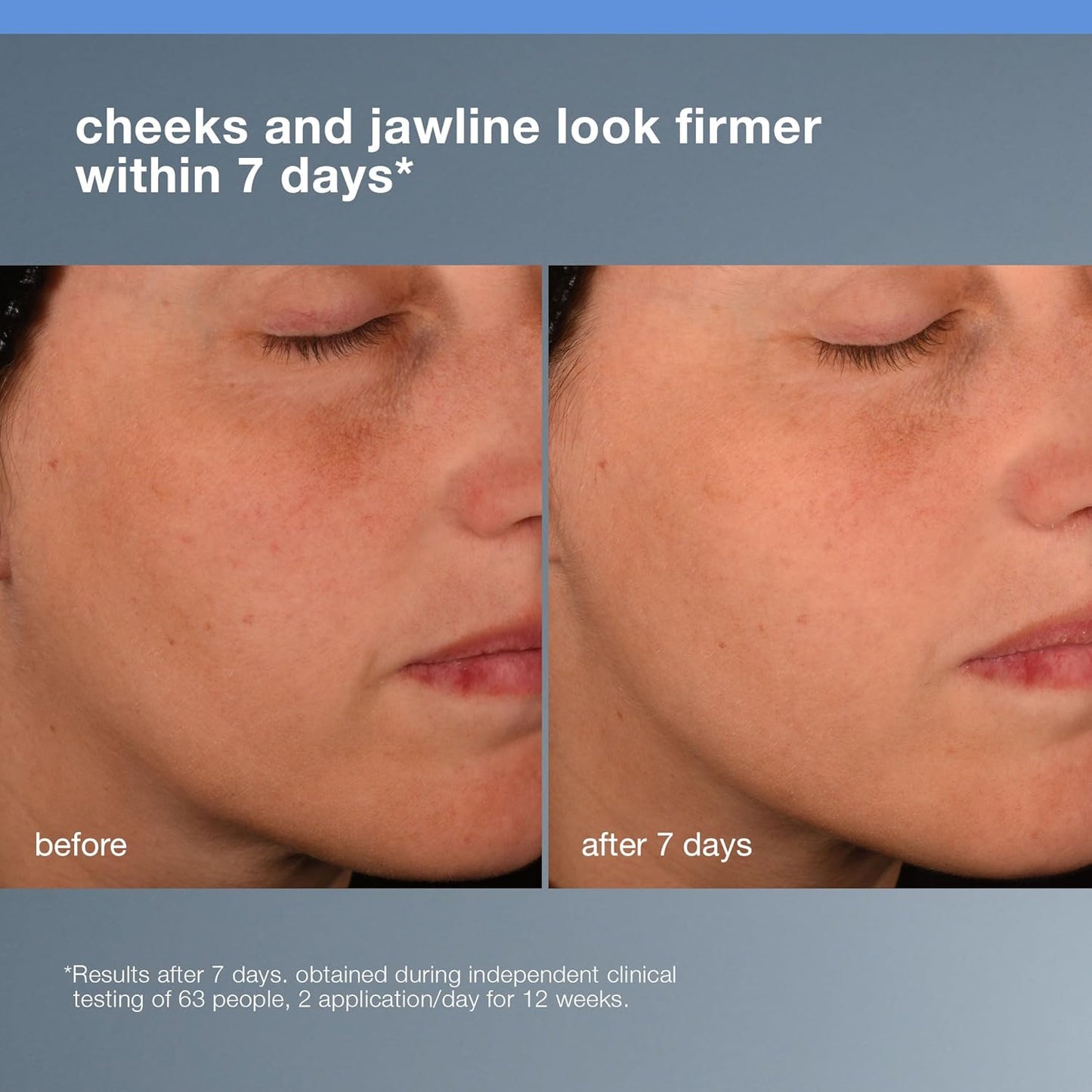 Dermalogica Pro Collagen Banking Serum for Face, Plumping and Preserving Skin's Collagen, Prevent Wrinkles and Fine Lines with Amino Acid, 2 fl oz