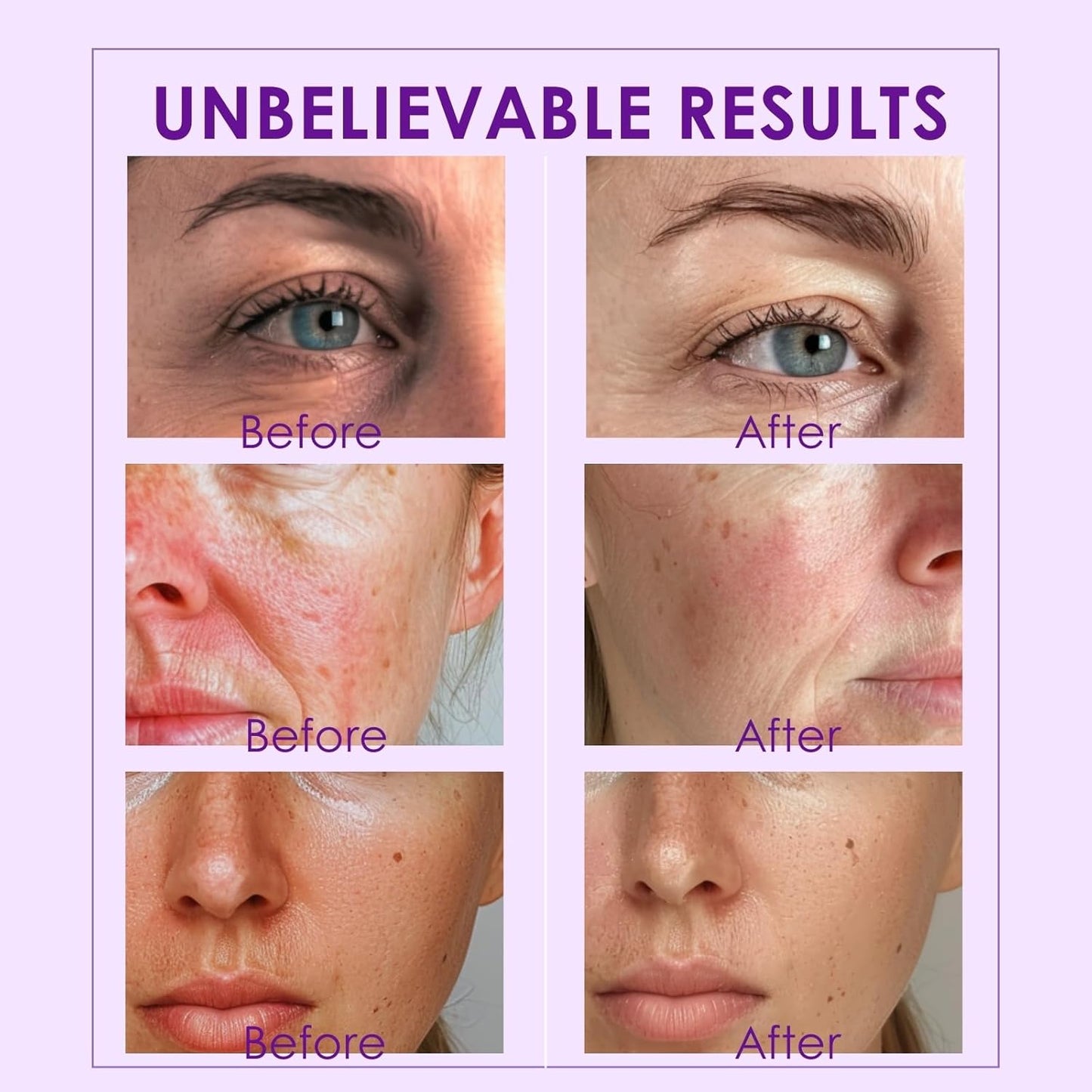 Ice Globes for Face and Eyes, Cooling Facial Massage Tool, Cryo Beauty Roller for Puffiness, Redness, Fine Lines & Wrinkles, Skincare Gift for Home Spa Use