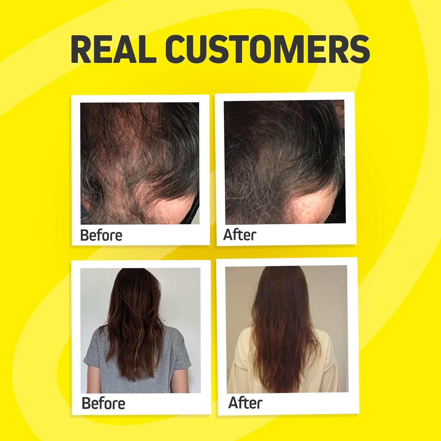 Hair Growth Vitamins for Women & Men | DHT Blocker with Saw Palmetto & 10000mcg Biotin, Foli Tonic Hair Growth Supplement – Supports Fuller, Thicker Hair Appearance, Non-GMO, 60 Vegan Capsules