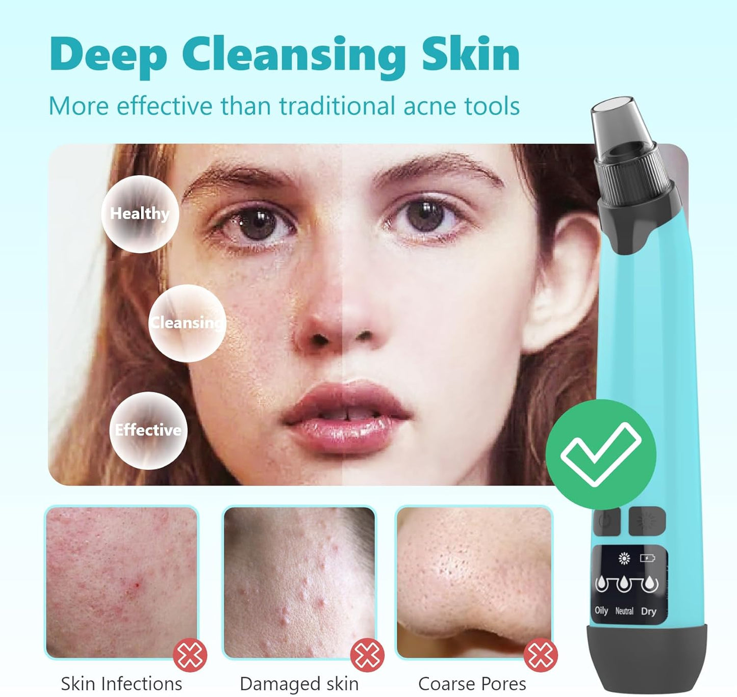 Blackhead Remover Vacuum - Black Head Remover for Face,Blackhead Extractor Tool with 3 Adjustable Suction Levels,4 Probes,USB Interface Type Pore Vacuum,Suitable for Women and Men (Blue)