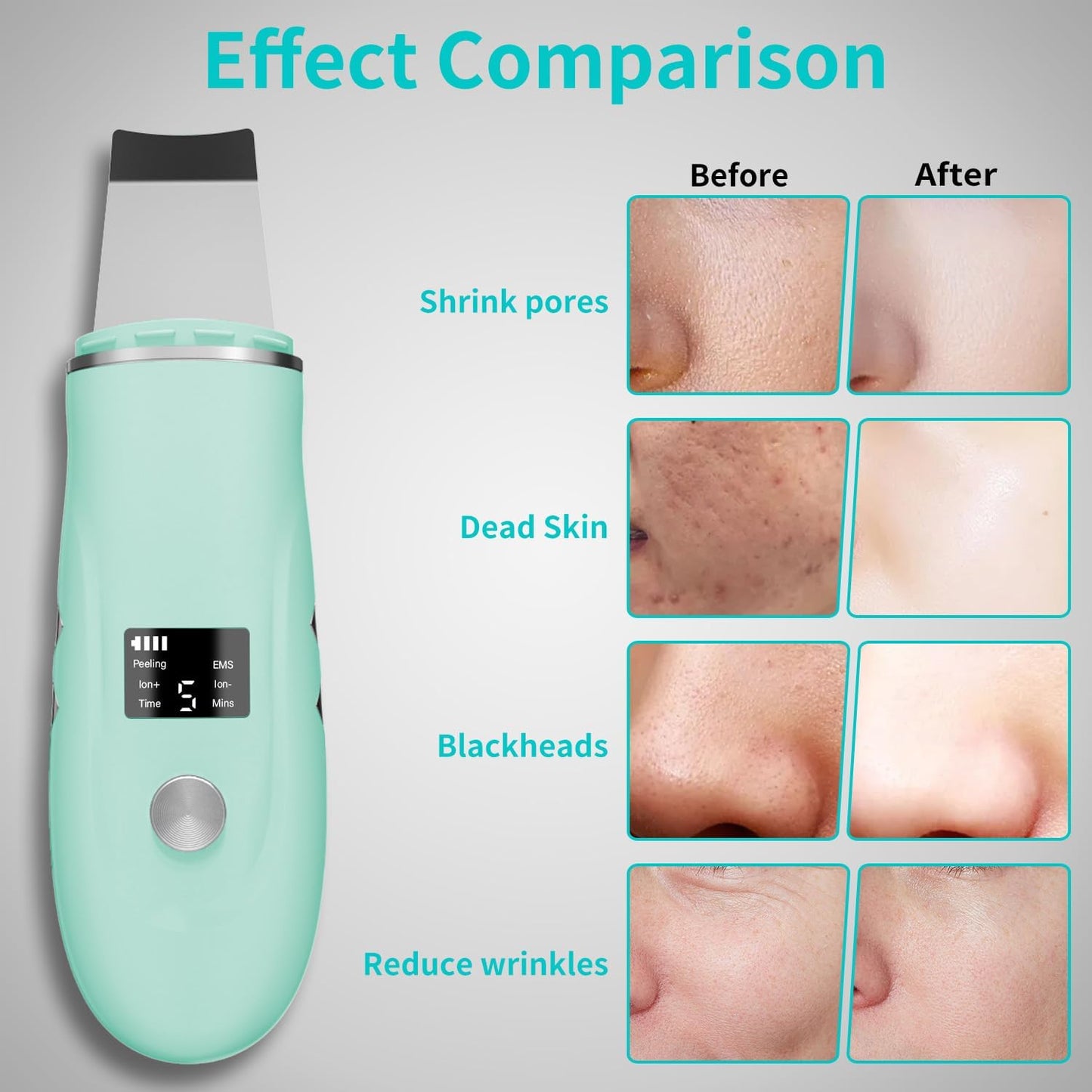 Face Scrubber Skin Spatula - Blackhead Remover Deep Cleansing Tool for Pore Extraction, 4-in-1 Fast Charging Dock Blackhead Remover Face Spatula for Facial Skincare Women Gift (Green)