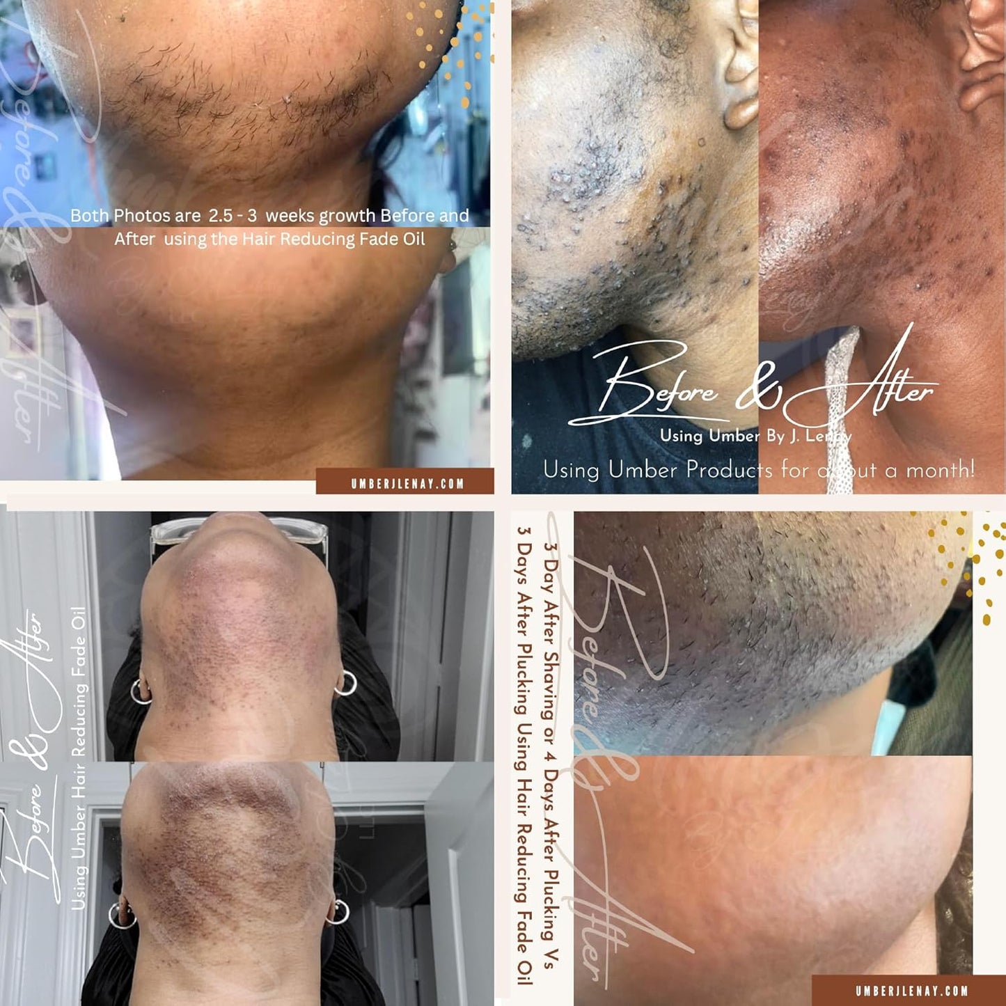 Hair Reducing Fade Oil - Sentive Strength (For sentive skin) Hair Growth Minimizer, Slow Down Facial Hair Growth for Women & Men, Hair Inhibitor Serum, Moisturizing & Soothing, 15ml