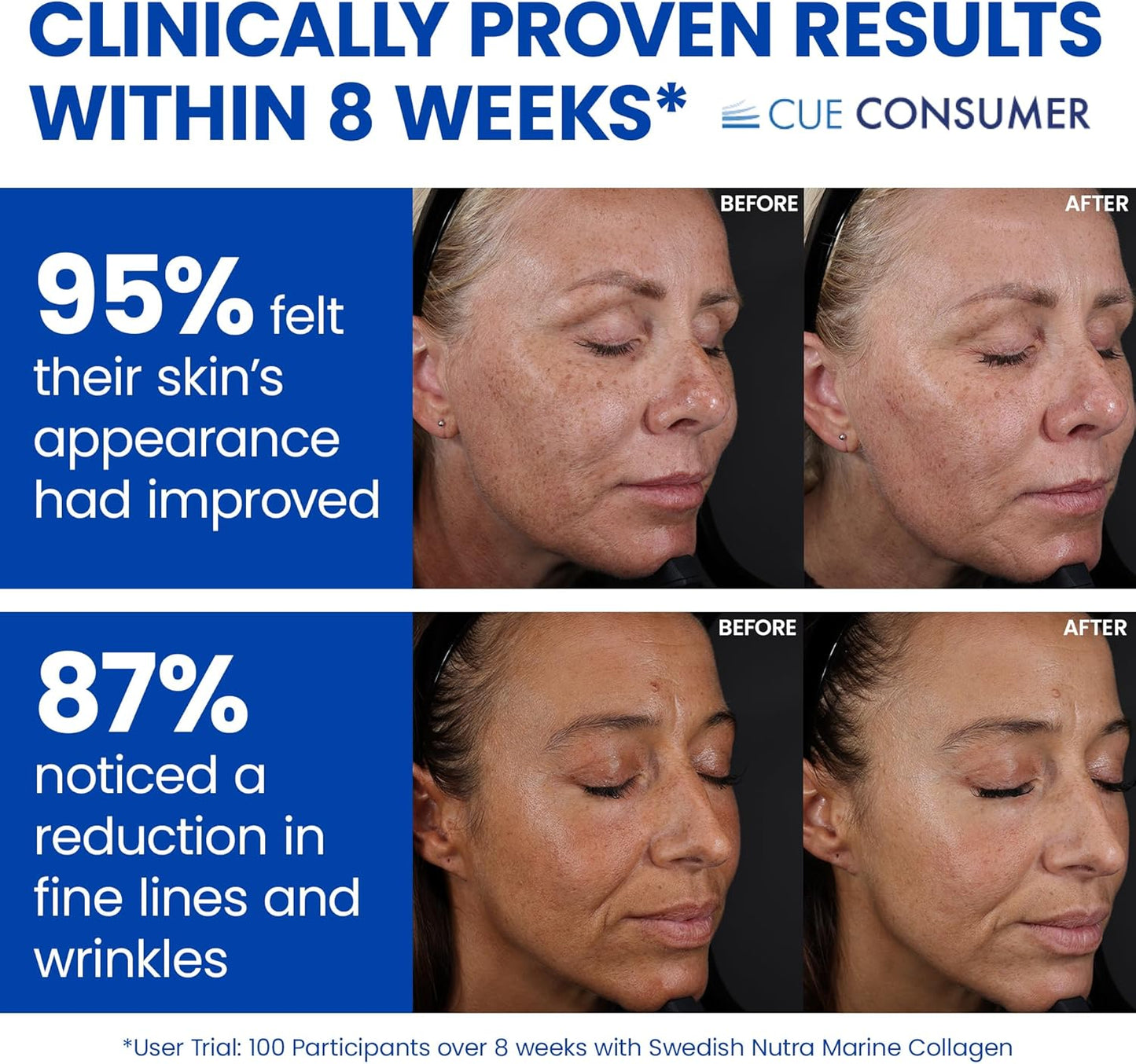 Swedish Nutra - Liquid Marine Collagen 10,000mg - 3 Packs of 500ml I Hydrolyzed Collagen Peptides (Type I & III) I Hyaluronic Acid, Biotin, Vitamin C - 60 Day Supply