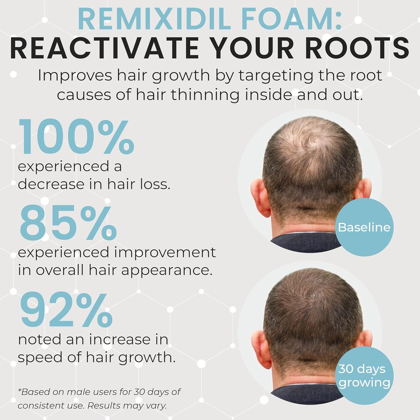 Remixidil Men’s 5% Minoxidil Foam | Hair Regrowth Treatment for Men | Clinically Proven Formula for Hair Loss and Hair Growth | No Scalp Irritation | 3-Month Supply