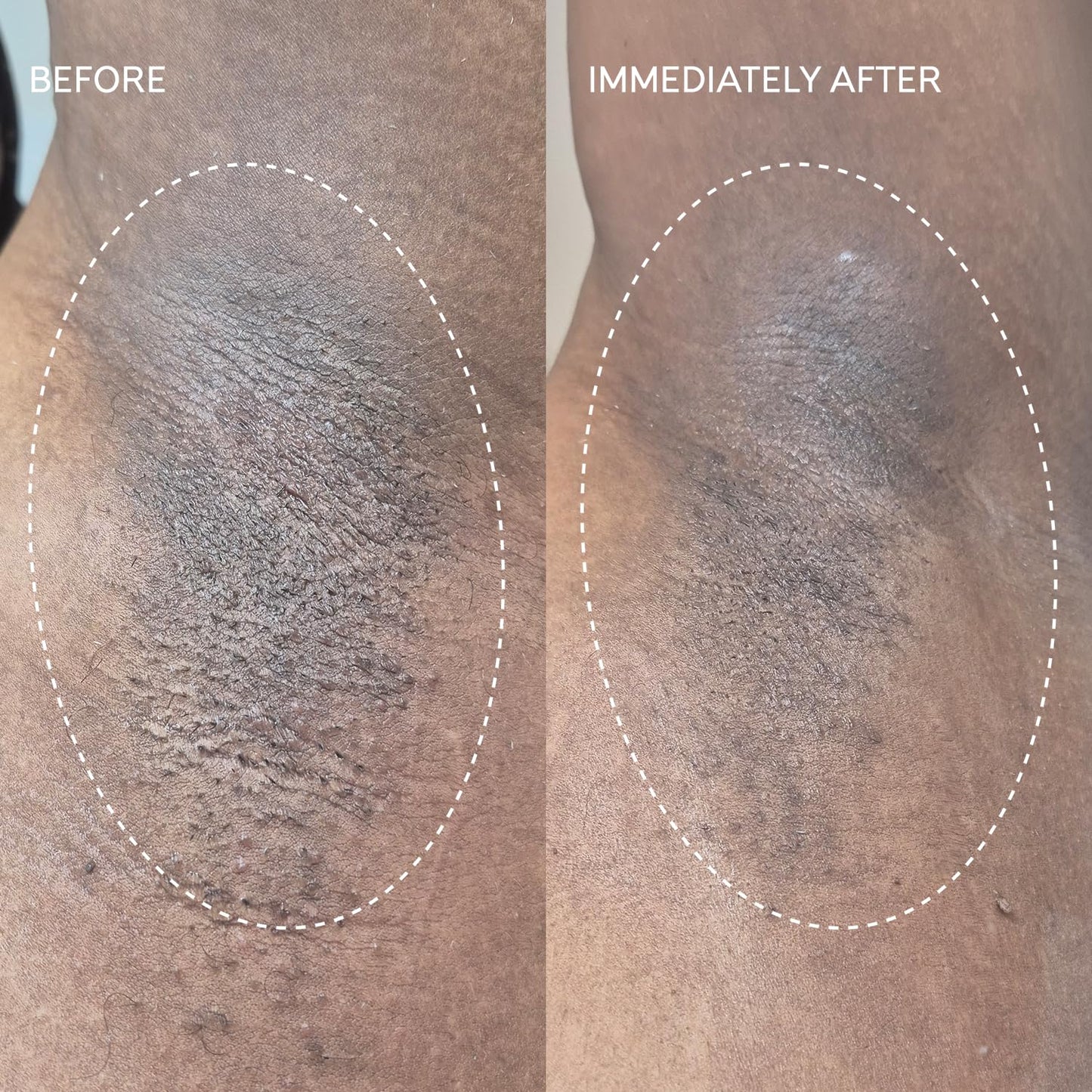 Fur Flash Repair Jelly – Hypochlorous Acid Aftercare Gel for Post-Wax, Shave, or Laser – Soothes Redness, Bumps, and Irritation Dermatologist-Tested, Fragrance-Free (2.0 fl oz / 60mL)