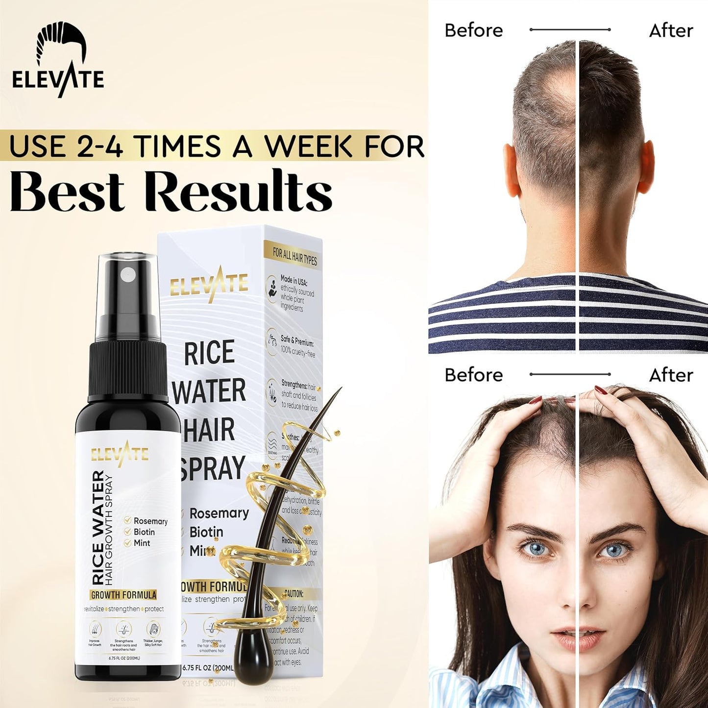 Elevate Rice Water Spray for Hair Growth - Fermented Rice Water & Rosemary Hair Mist with Biotin - Vegan Leave-In Treatment for Stronger, Thicker, Healthier Hair - Scalp Care for Women & Men